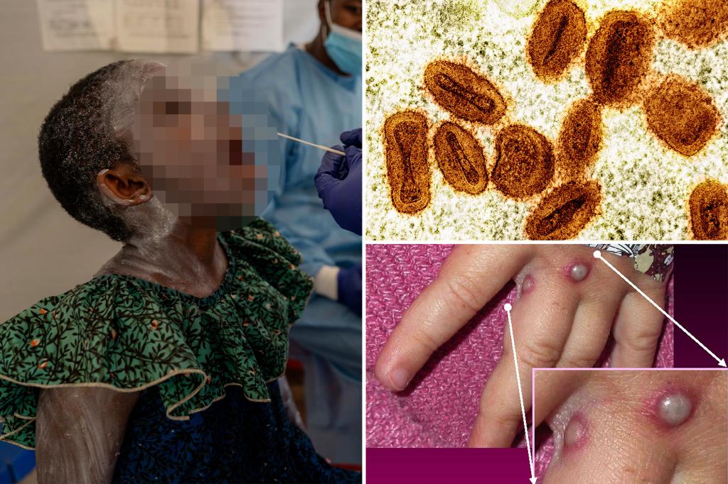 The first case of new strain beats in NY - What to know about your risk